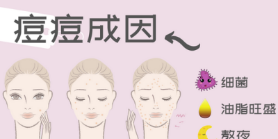 是你吗？过了青春期还在长痘的小可怜
